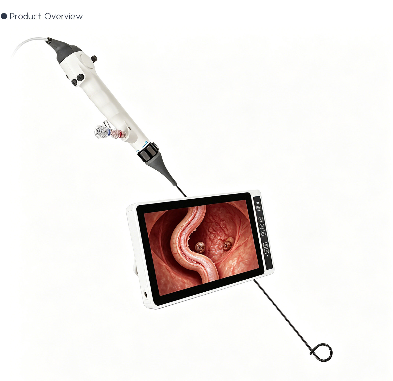 Disposable Electronic Ureteropelvic Endoscopic Catheter