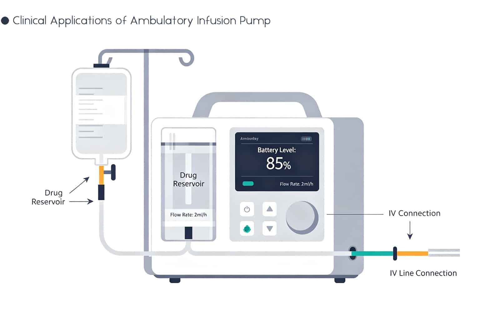 Ambulatory Infusion Pump