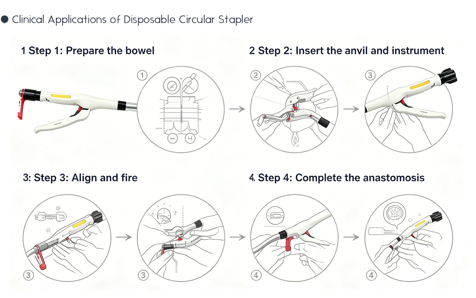 Disposable Circular Stapler