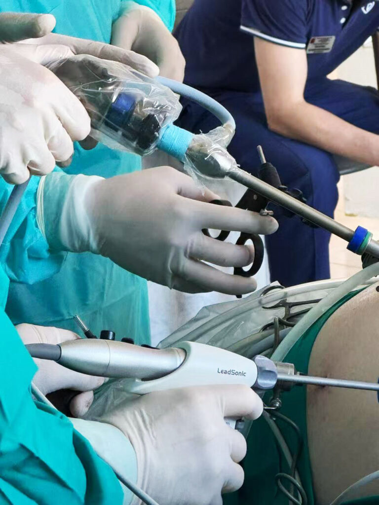 Bipolar Electrosurgical (LIGASURE Vessel Sealer) System surgery